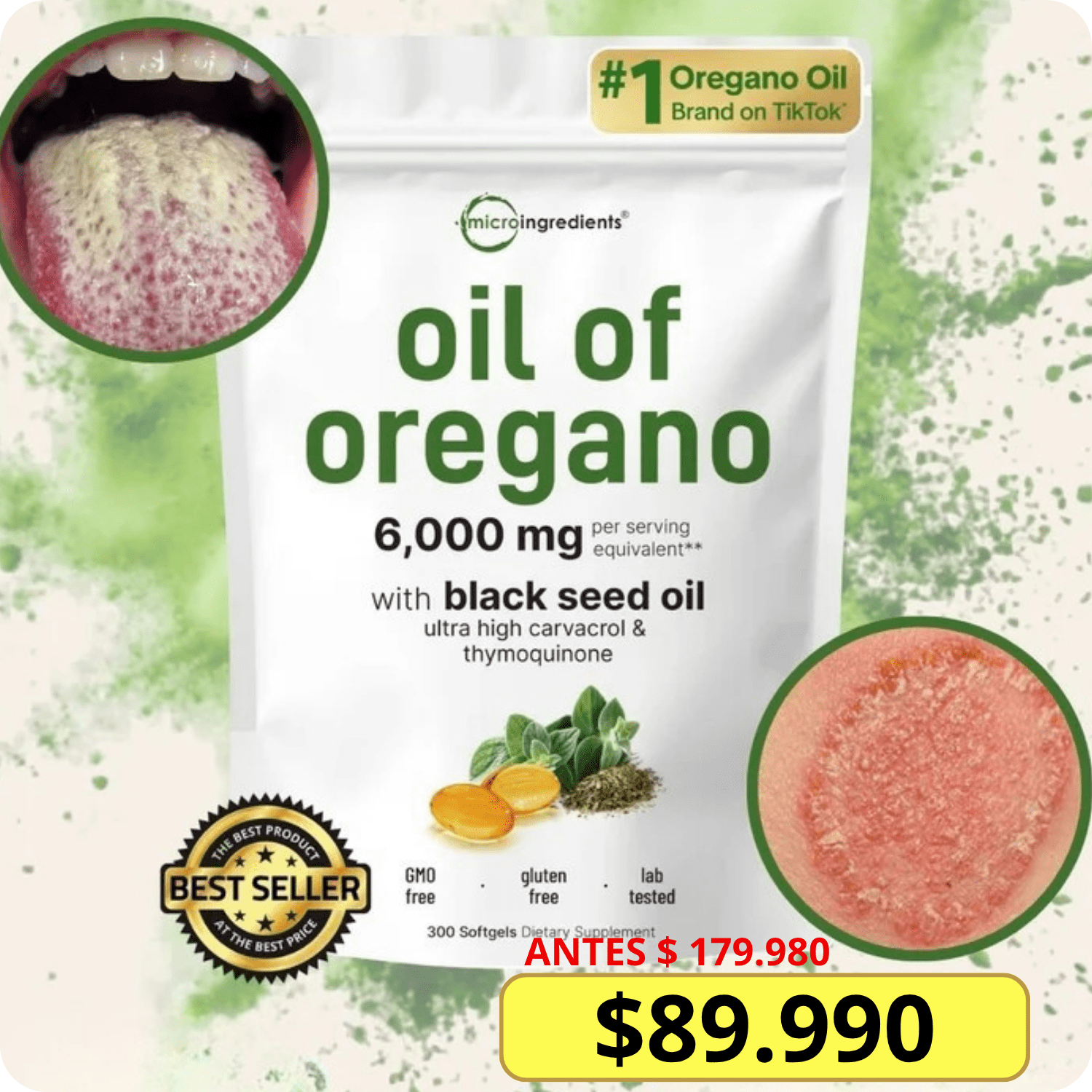 CAPSULAS DE ACEITE DE OREGANO CON SEMILLAS NEGRAS + ENVIO GRATIS - Image 10