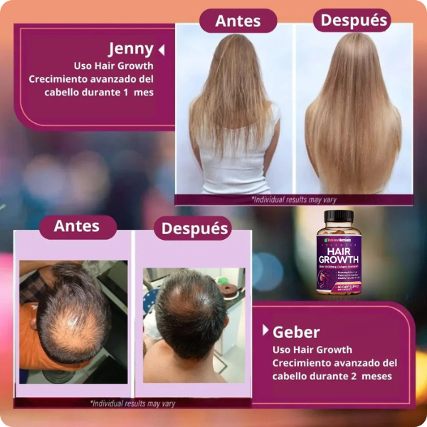 HAIR GROWTH ADVANCED - Resultados visibles en pocas semanas! - Image 4